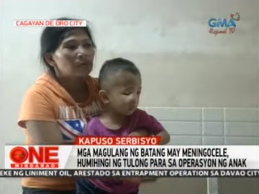 One Mindanao Batang May Sakit Nais Ma Operahan One Mindanao GMA