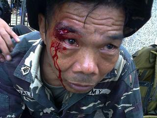 Wounded soldier adds to growing casualties in Zambo crisis