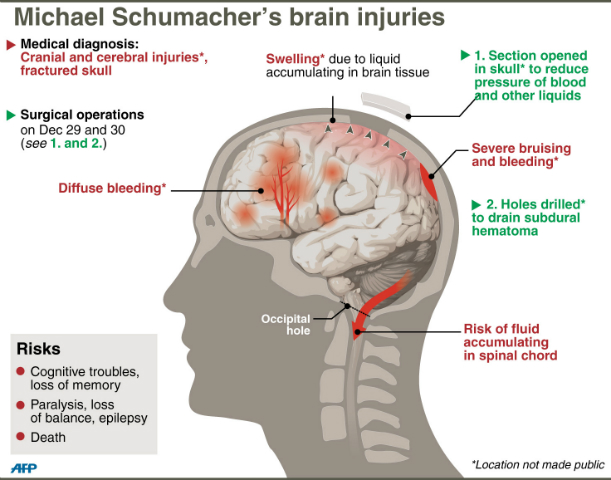Family Hails Fighter Schumacher As Driver Turns 45 In Coma