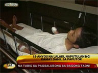 15-year-old boy loses hand to 'Atomic Bomb'
