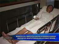  Saksi:  Minor lost arm to 'atomic bomb' firecracker
