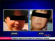  QTV:  Nurse sues Belo group over failed skin procedure