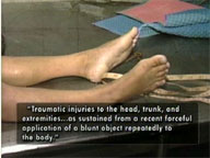  Saksi:  Father beats 7-year-old son to death