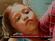 <b>Kapusong Totoo: </b>Help reaches girl who lost foot to disease