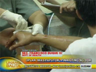 DOH pushes onward with Oplan Iwas-Paputok