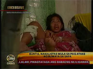 Pregnant woman survives crocodile attack in Isabela