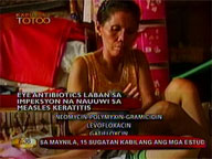 <b>Kapusong Totoo: </b>How to avoid measles
