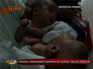 <b>Kapusong Totoo: </b>Conjoined twins