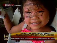 6-year-old girl saves her baby sibling from fire