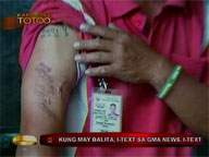 <b>Kapusong Totoo: </b>Public warned vs rabies