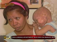 <b>Kapusong Totoo: </b>Help reaches Baby Dodong who has skin asthma