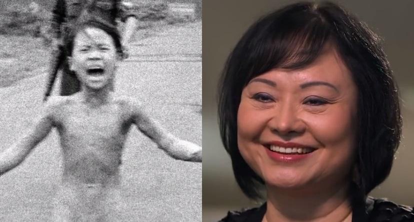 Vietnamese Girl Burned by Napalm Focuses on Forgiveness 