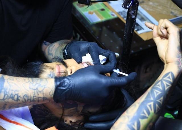 Beng Espiritu of Skin Works performed the procedure on Otomamay Haruki