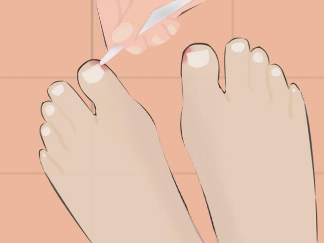 How to prevent those painful ingrown toenails, according to experts | GMA  News Online