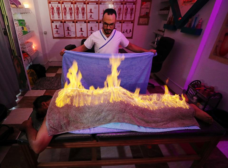 Massage therapist Abdel Rehim Saeid performs the "fiery towel" method to ease a patient's muscle pain in Gharbia, Egypt September 4, 2019. Picture taken September 4, 2019. REUTERS/Mohamed Abd El Ghany