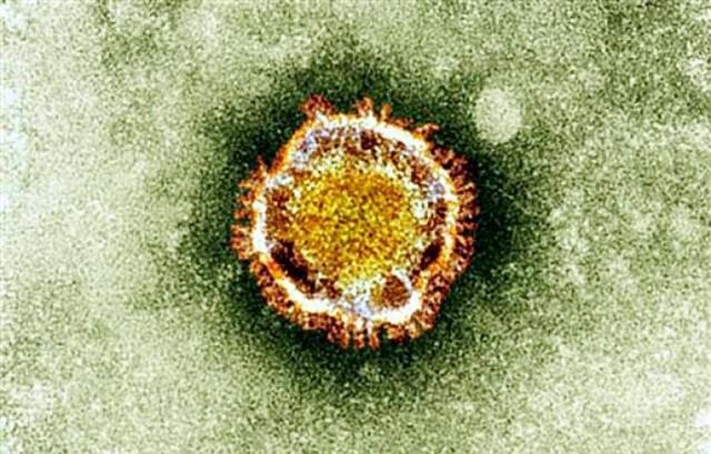 This undated handout picture courtesy of the British Health Protection Agency shows the Coronavirus seen under an electron microscope. French health authorities said early on May 12, 2013 that a second person had contracted a deadly new SARS-like virus, after sharing a hospital ward with the first victim identified in the country.The virus, known as nCoV-EMC (new coronavirus), is a cousin of Severe Acute Respiratory Syndrome (SARS), which triggered a scare 10 years ago when it erupted in east Asia, leaping to humans from animal hosts and killing some 800 people. AFP PHOTO / BRITISH HEALTH PROTECTION