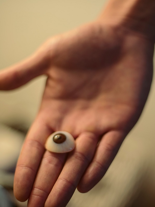 Magic Mark shows off his prosthetic eye.