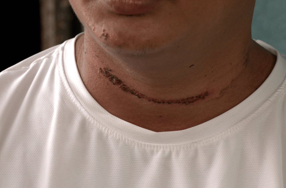 Photo via GMA Regional TV Balitang Southern Tagalog