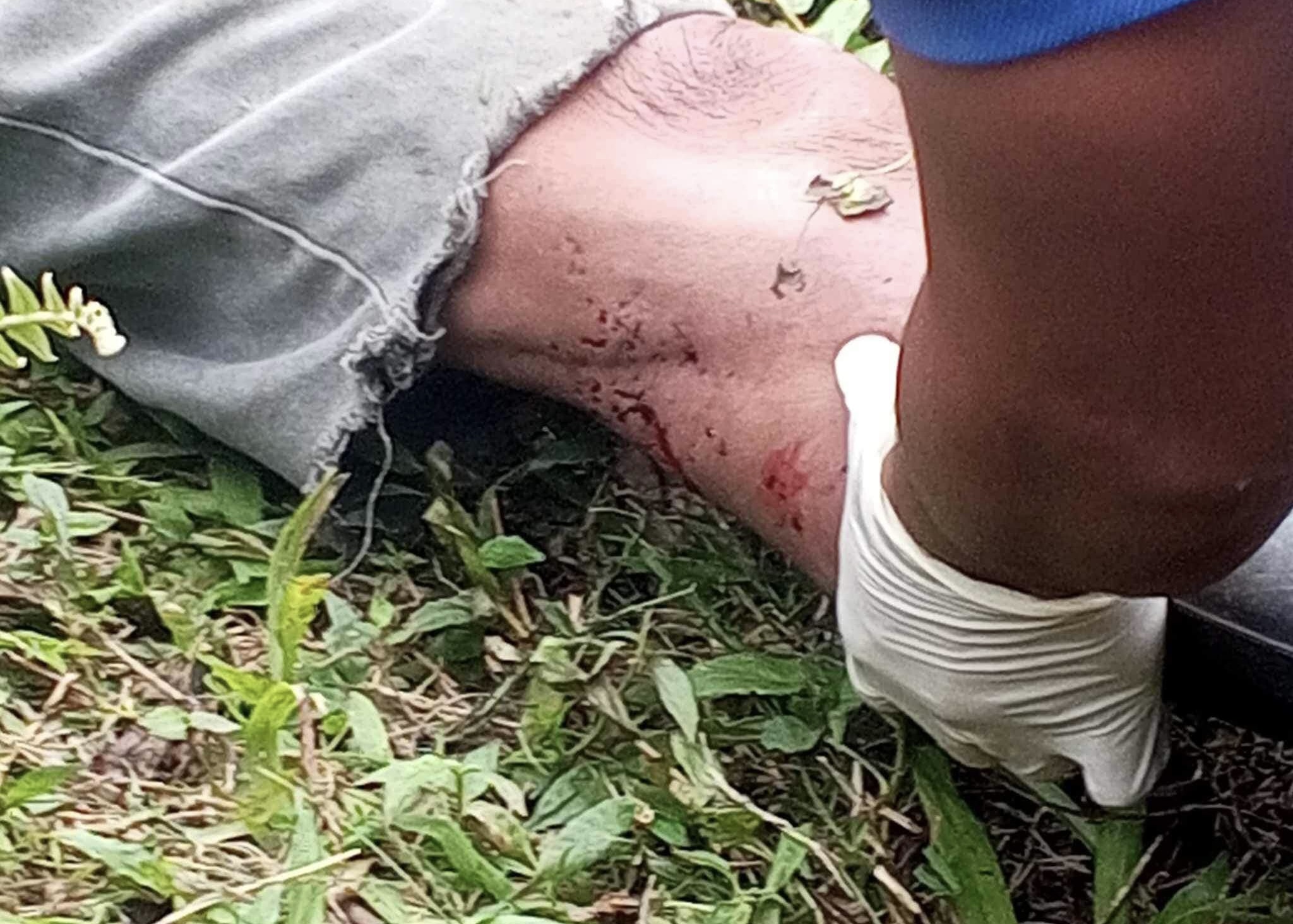 Image courtesy: Joy Ambayec FB