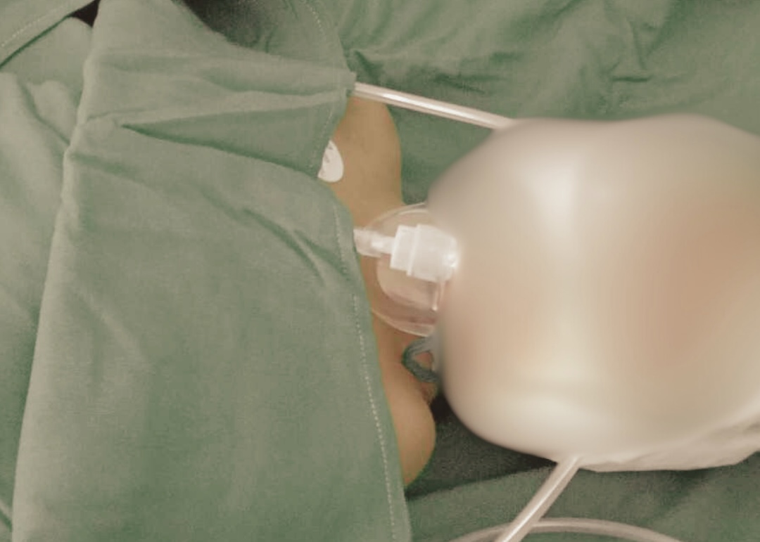 Image courtesy: Rene Djrj Castino/FB