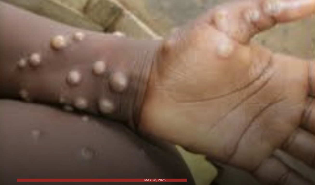 Image courtesy: World Health Organization via GMA Super Radyo Iloilo