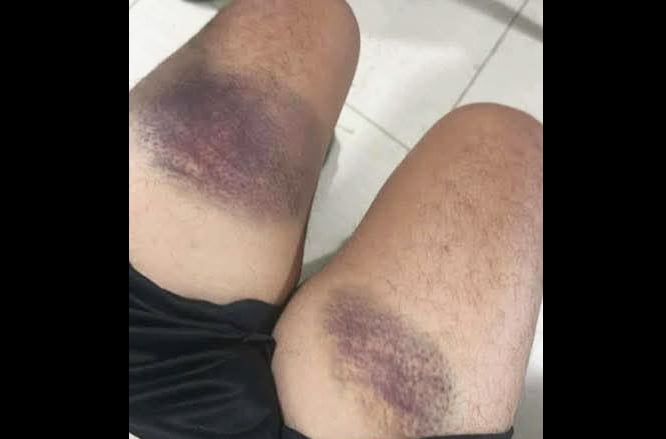 Photo via GMA Regional TV One Mindanao