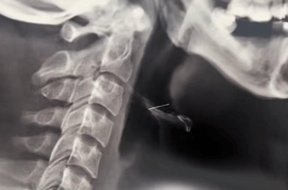 Photo courtesy of Vincent John Jocson via Kuya Kim Ano Na / 24 Oras