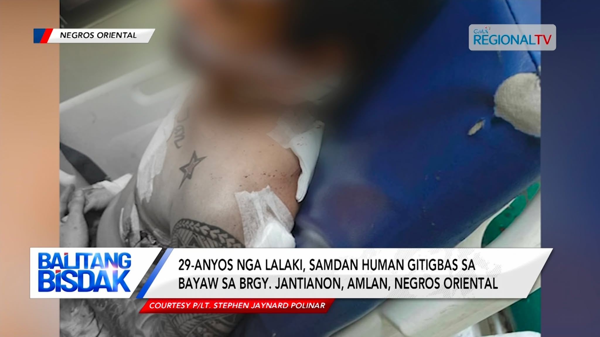 29-anyos nga lalaki, samdan human gitigbas sa bayaw sa Negros Oriental