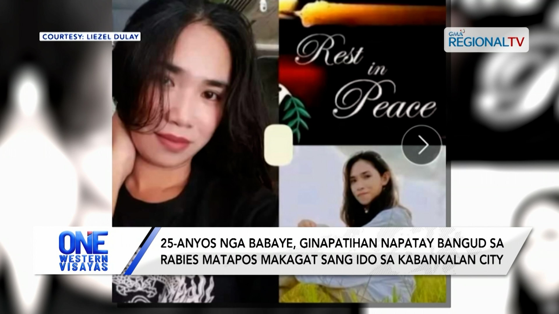 Babaye, ginapatihan napatay bangud sa rabies; nakagat sang ido sa Kabankalan