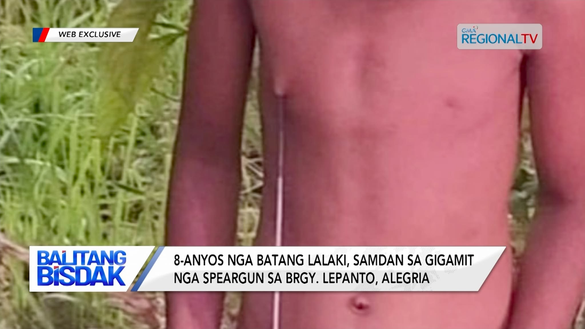 8-Anyos nga Lalaki, Naigo sa Pana sa Speargun sa Brgy. Lepanto, Alegria | Balitang Bisdak