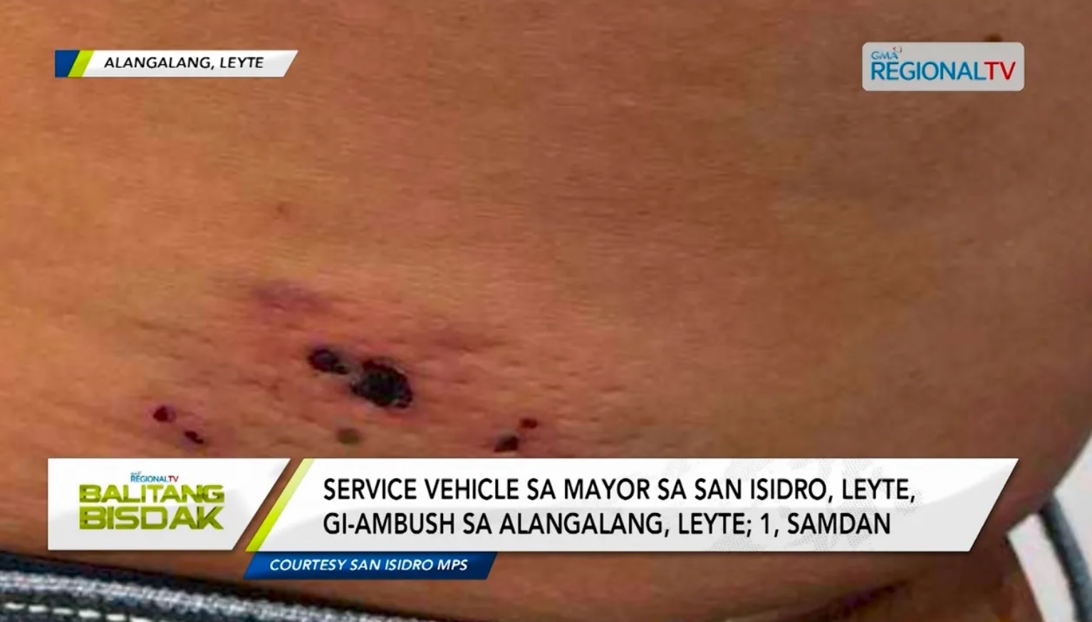 Service vehicle sa mayor sa San Isidro, Leyte, gi-ambush; 1, samdan