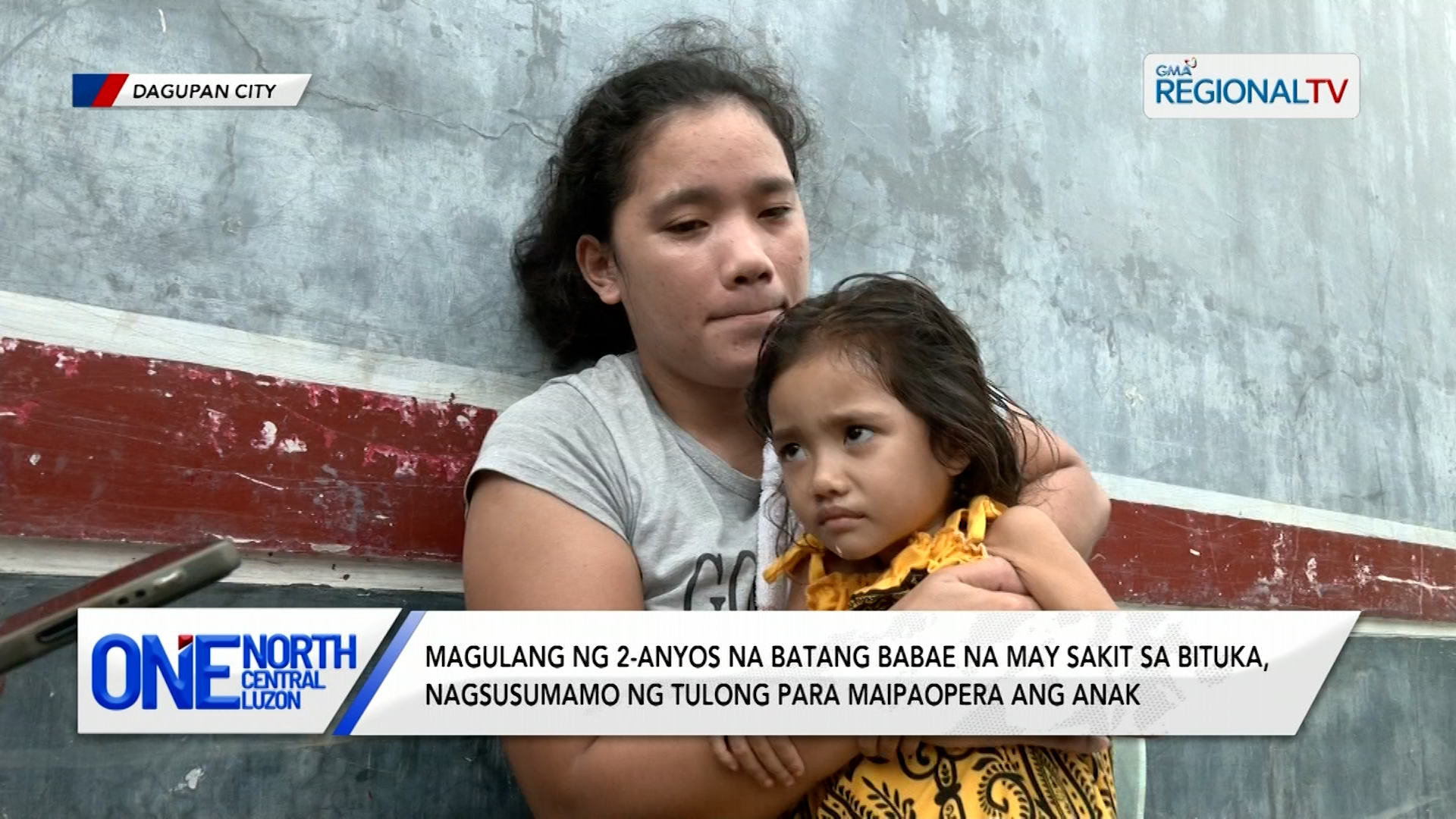 Magulang ng 2-anyos na bata na may sakit sa bituka, nagsusumamo ng tulong