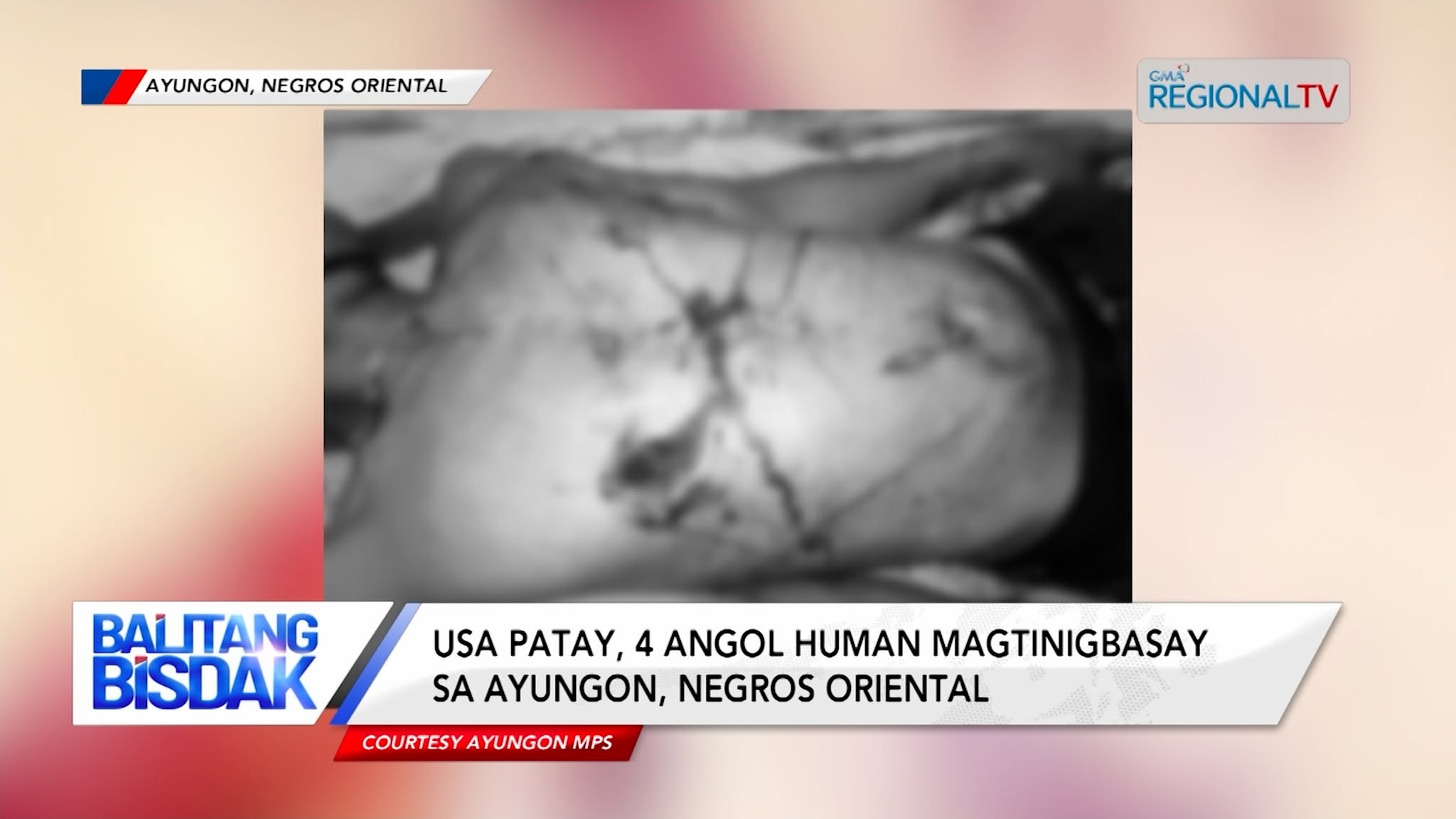 1 Patay, 4 Angol sa Nahitabong Tinigbasay sa Negros Oriental | Balitang Bisdak