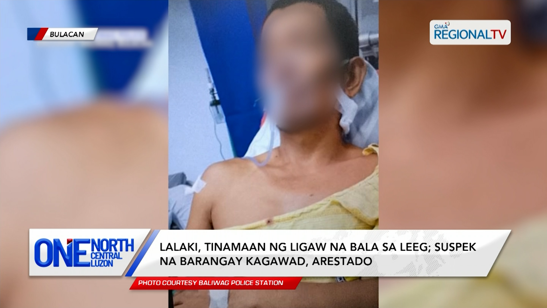 Lalaki, tinamaan ng ligaw na bala sa leeg; suspek na kagawad, arestado | One North Central Luzon