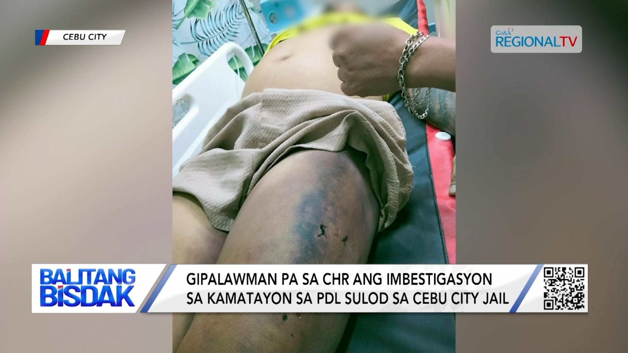 Gipalawman pa sa CHR ang Imbestigasyon sa Kamatayon sa PDL sulod sa Prisohan | Balitang Bisdak
