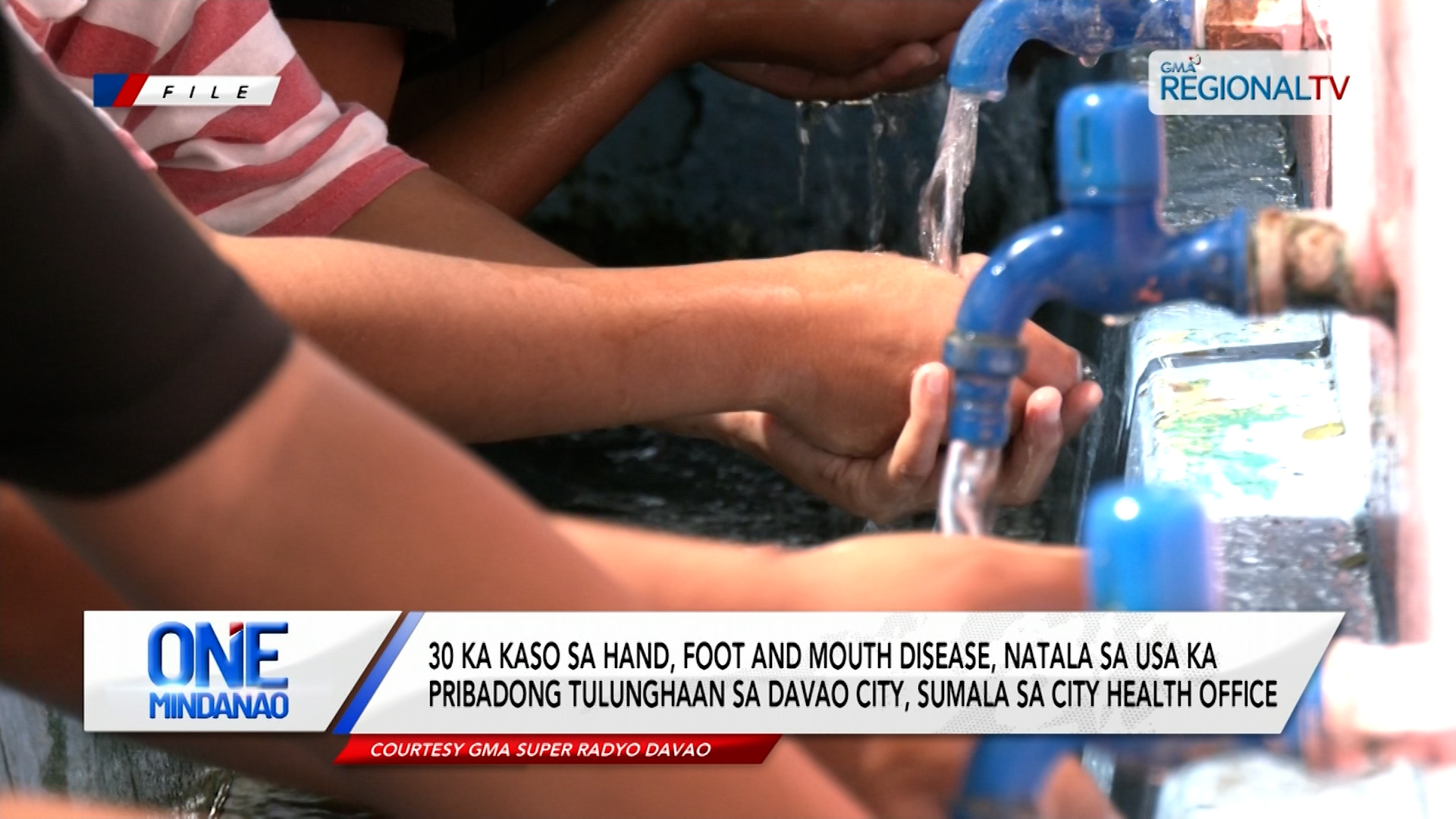 30 ka kaso sa hand, foot and mouth disease, natala sa Davao City, sumala sa CHO