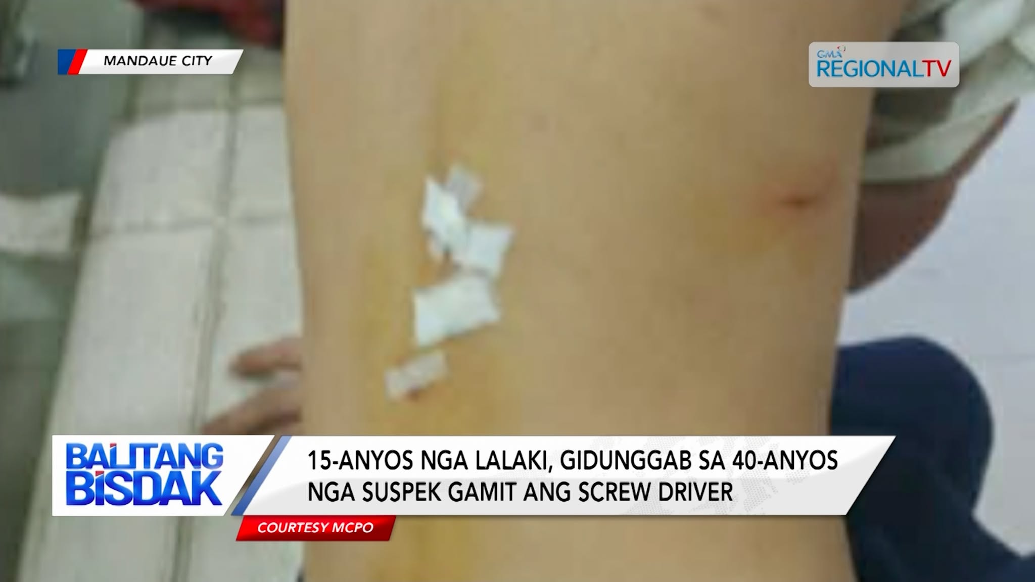 15-anyos nga Lalaki, Gidunggab sa 40-anyos nga suspek Gamit ang Screw Driver | Balitang Bisdak