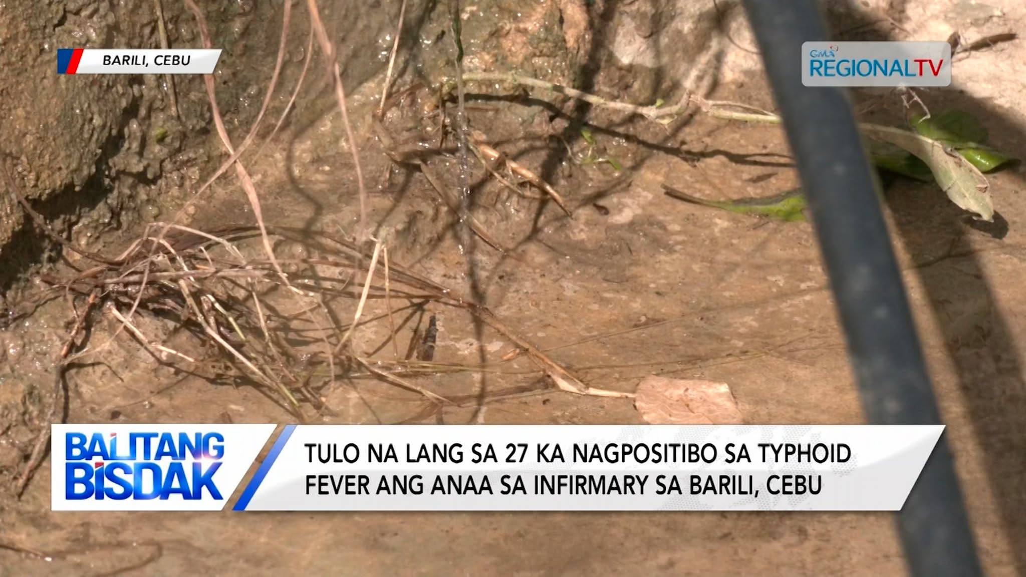 3 ka nagpositibo sa typhoid fever ang anaa nalang sa infirmary sa Barili, Cebu