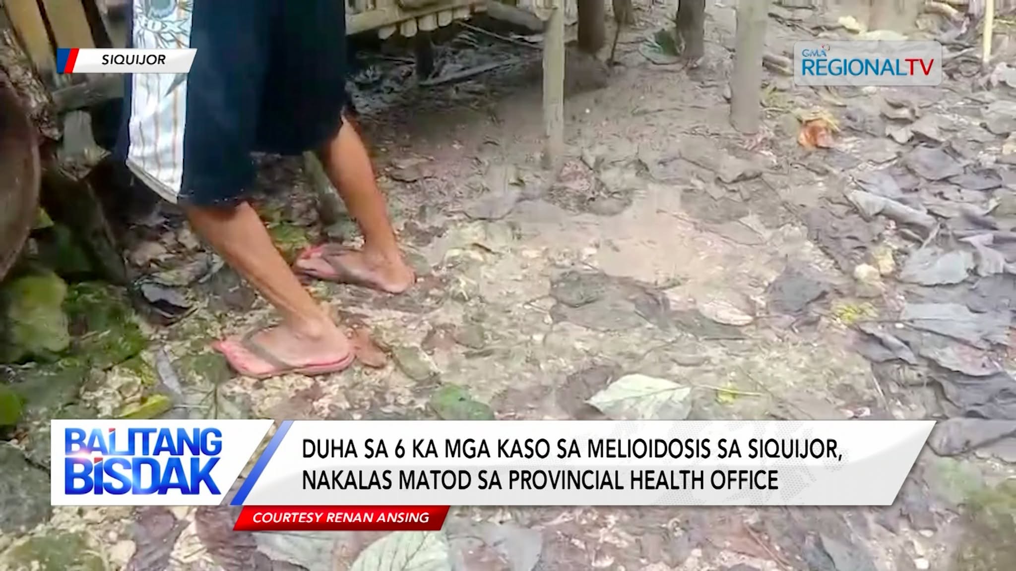 Patay ang duha sa 6 ka mga nataptan sa Melioidosis sa Siquijor