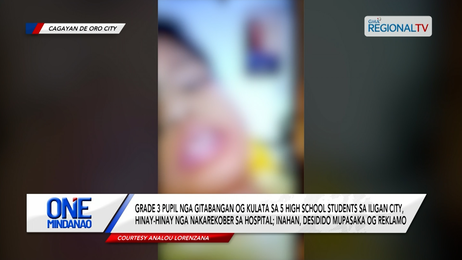 Grade 3 pupil nga gitabangan og kulata sa Iligan City, nakarekober na | One Mindanao