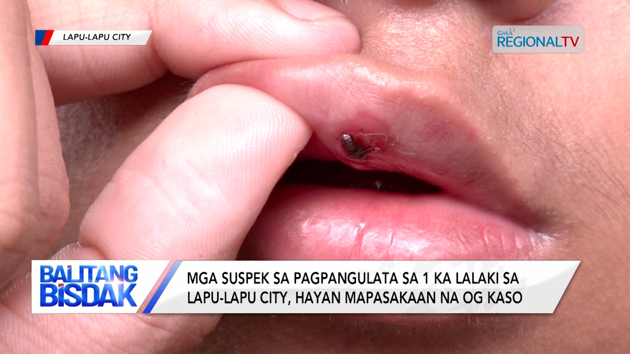 Mga suspek sa pagpangulata sa 1 ka lalaki sa Lapu-Lapu City, hayan kasohan na| Balitang Bisdak