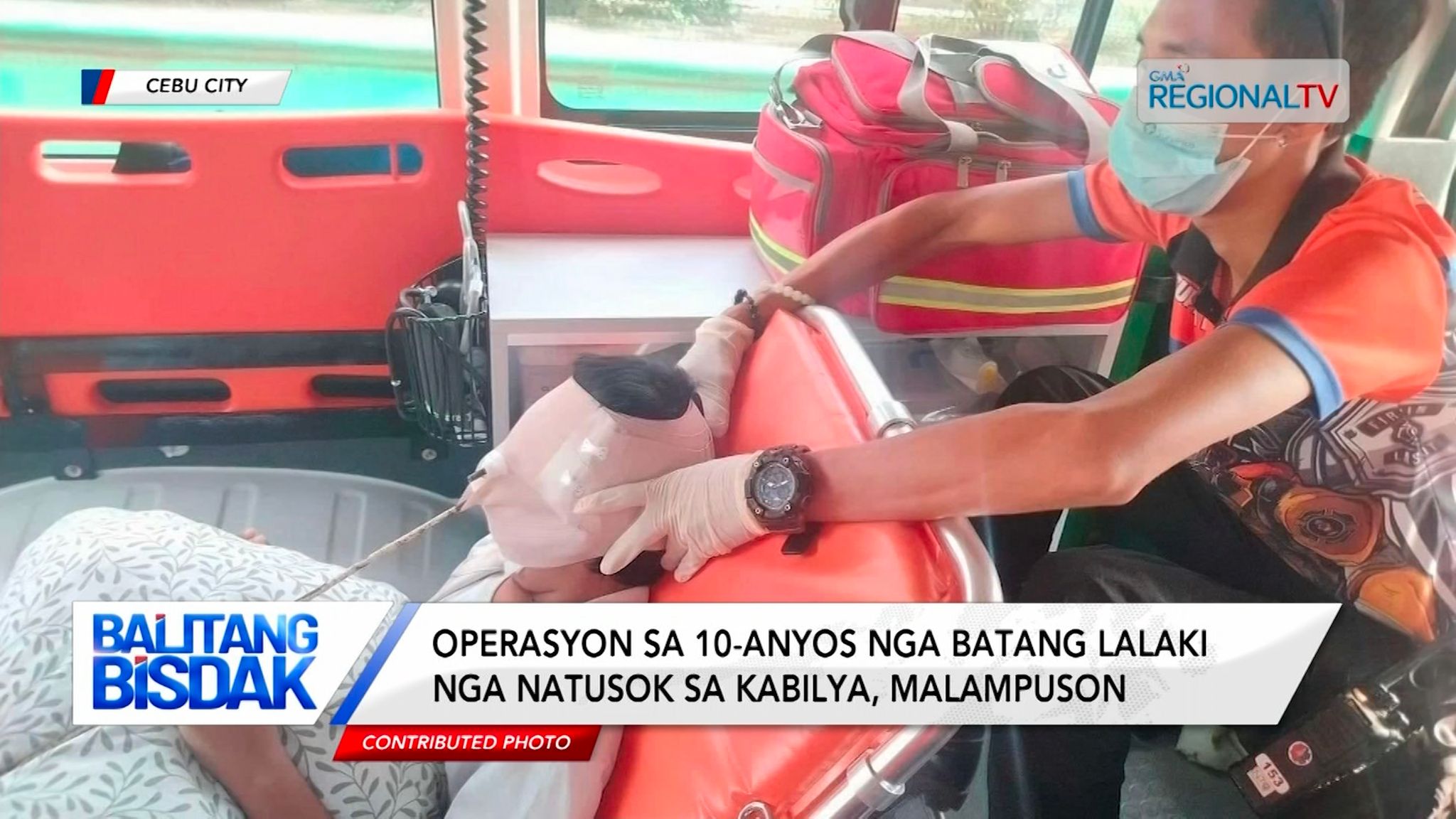 Operasyon sa 10-anyos nga batang lalaki nga natusok sa kabilya, malampuson