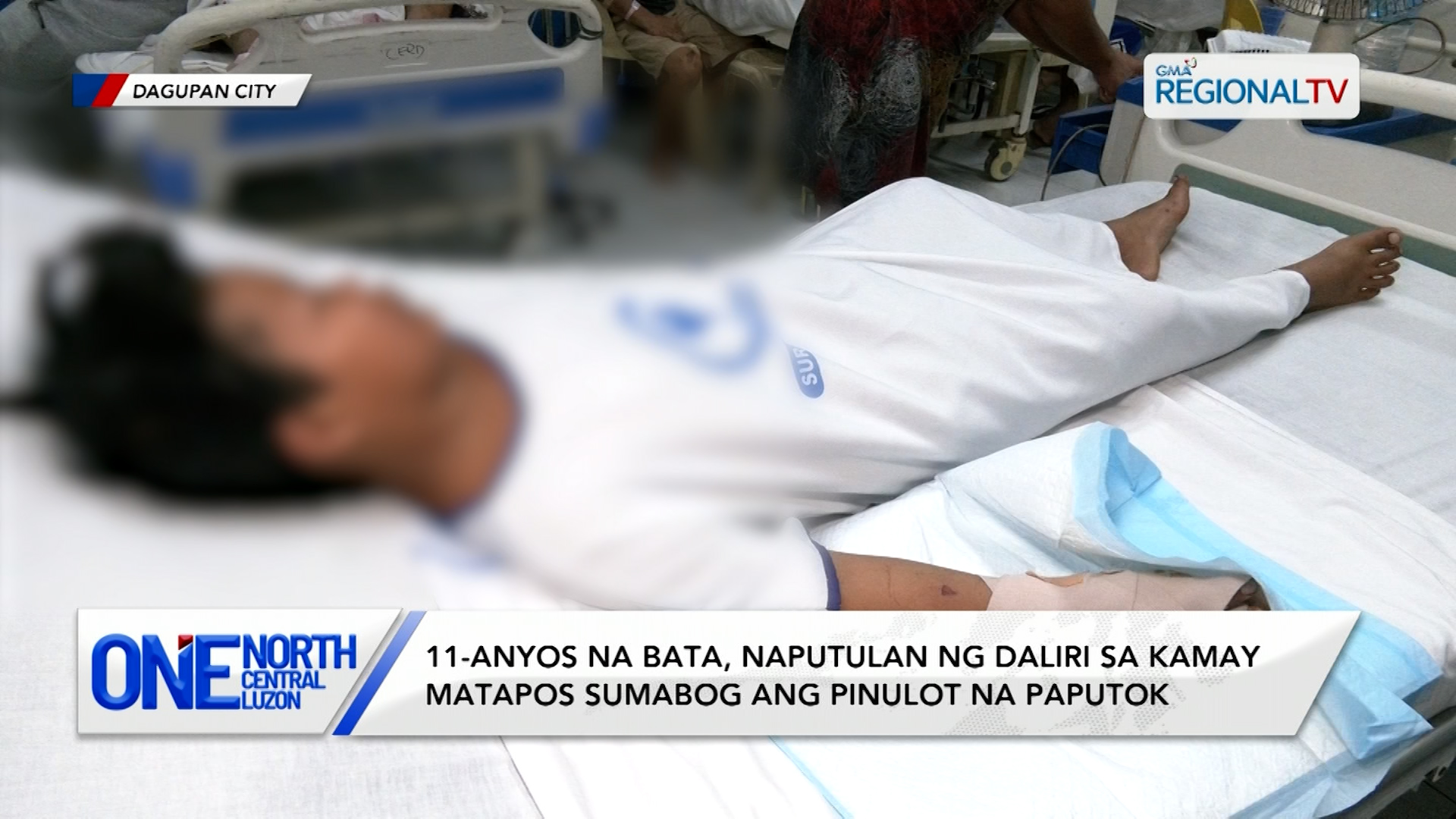 Bata, naputulan ng daliri matapos sumabog ang pinulot na paputok | One North Central Luzon