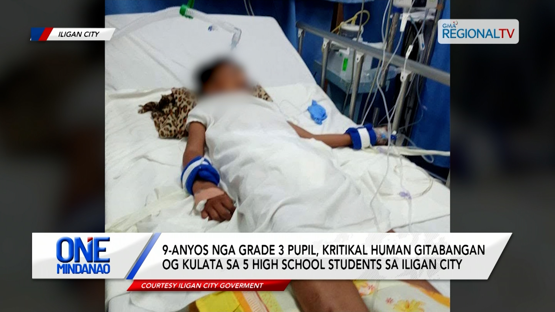 9-anyos nga grade 3 pupil, kritikal human gitabangan og kulata sa Iligan City| One Mindanao