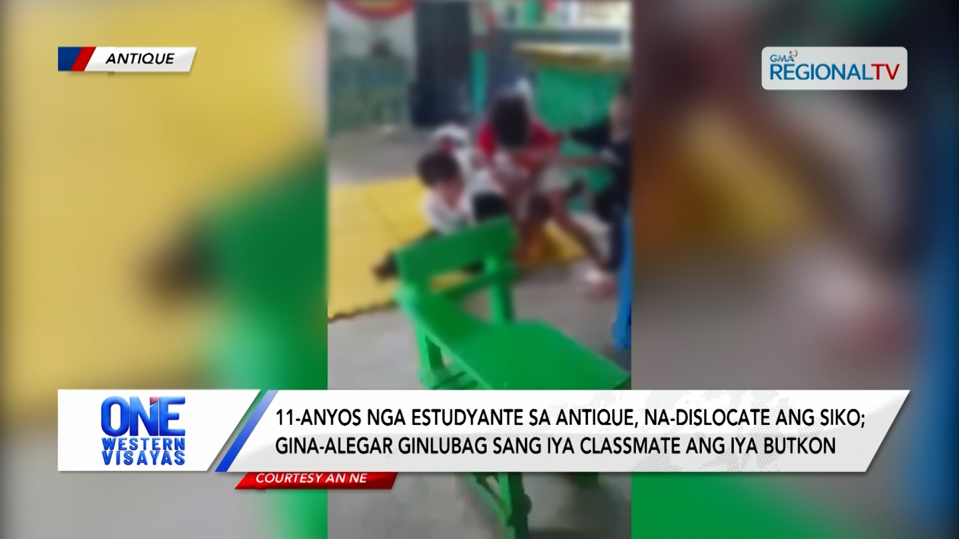 11-anyos nga estudyante sa Antique, nagliw-as ang siko; gina-alegar gina-bully | One Western Visayas