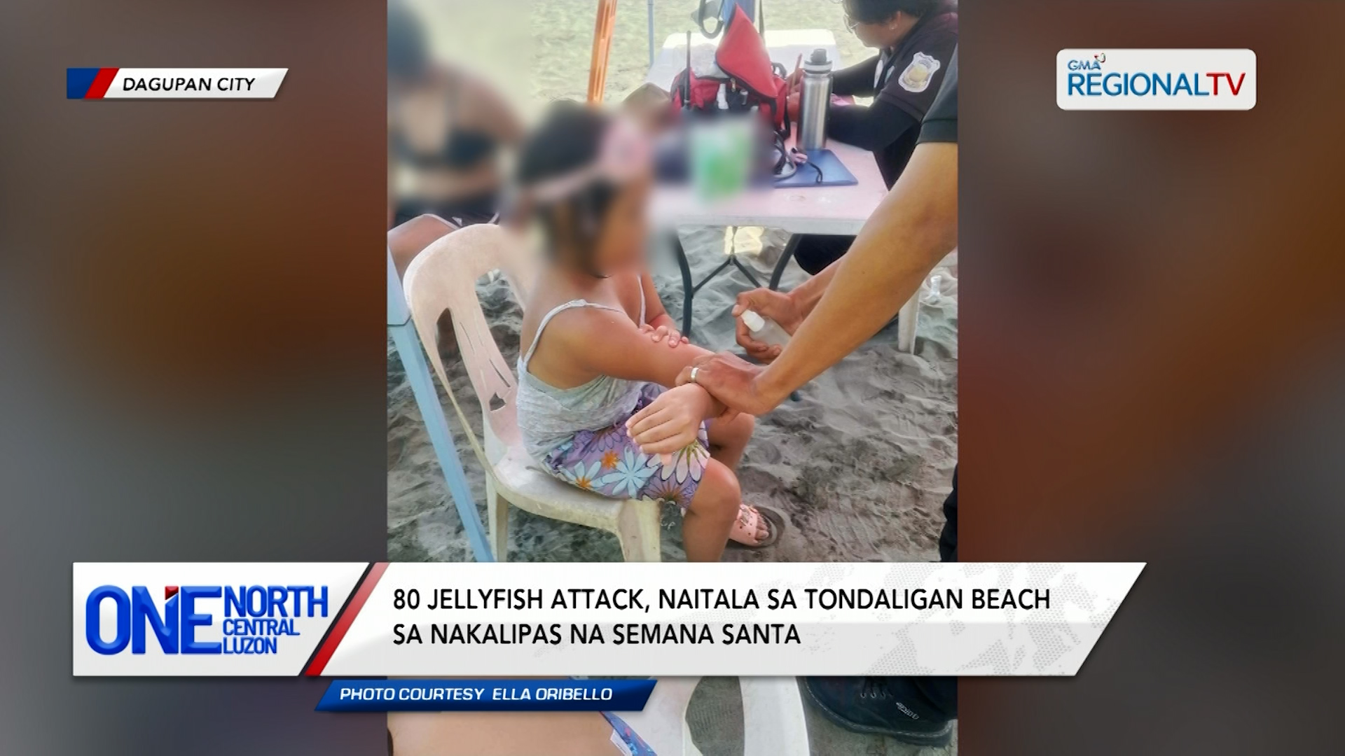 80 jellyfish attack, naitala sa Tondaligan Beach noong Semana Santa | One North Central Luzon