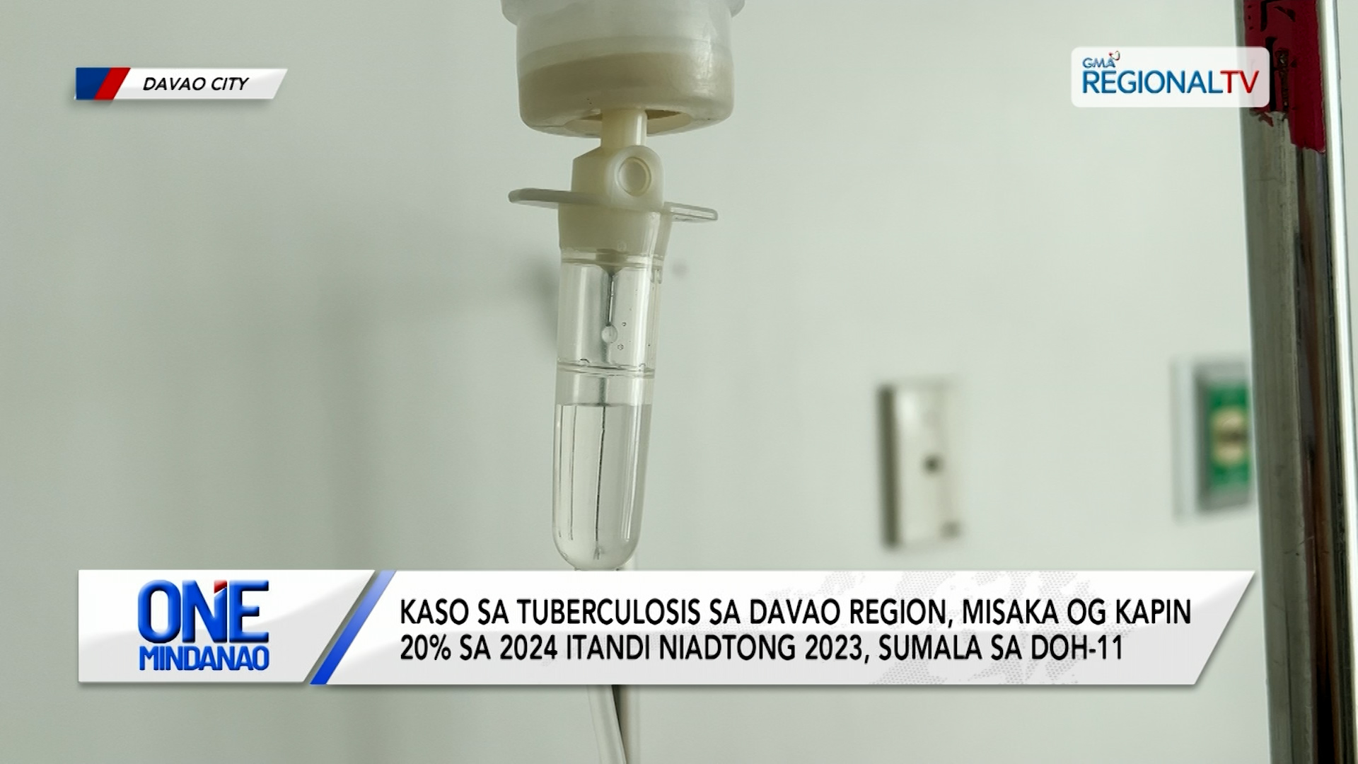 TB sa Davao Region, misaka og kapin 20% sa 2024, sumala sa DOH-11