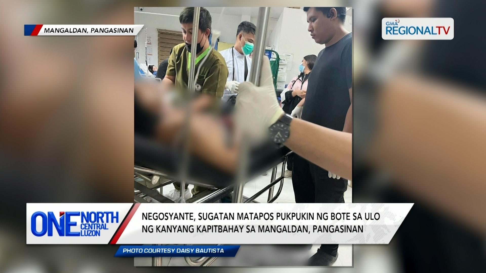 Negosyante, sugatan matapos pukpukin ng bote sa ulo ng kanyang kapitbahay | One North Central Luzon