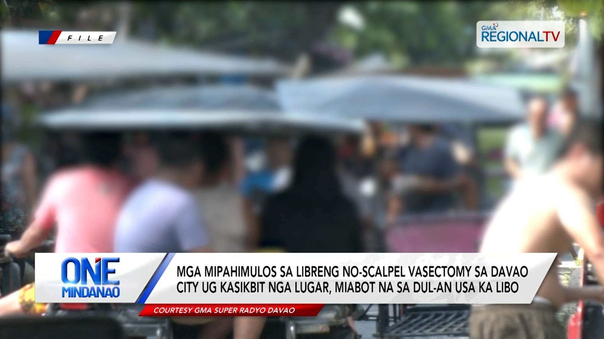 Mga mipahimulos sa no-scalpel vasectomy, miabot na sa dul-an usa ka libo