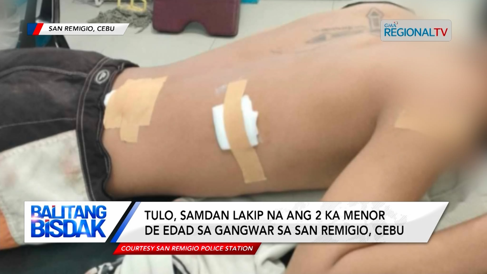 3 samdan lakip na ang 2 ka menor de edad sa gangwar sa San Remigio, Cebu